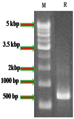 Larvicidal, Histopathological Efficacy of Penicillium daleae against Larvae of Culex quinquefasciatus and Aedes aegypti Plus Biotoxicity on Artemia nauplii a Non-target Aquatic Organism